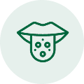 Candidal stomatitis (oral thrush - Oral Fungal Infection)